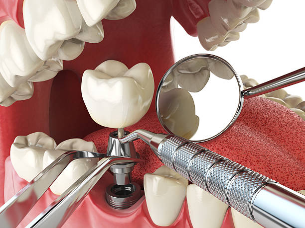 Best Emergency Denture Repair in Dallastown, PA
